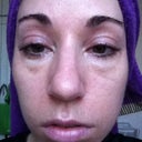 Morning puffiness...imagine my heartbreak