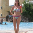 2 years post op