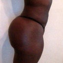 2 months post