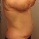 sides still swollen, but better