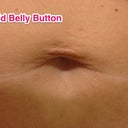 Old very sad belly button. I had a piercing from when I was 16 before it was cool to do. After having my first born it stretched out....gross!