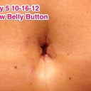 I am hopefully that my new belly button will not have a big circle around it & my dr cut away the old piercing flab.