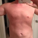Day before surgery