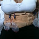 day 1 post op 3/23/11