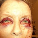 Eye that needed 3 more stitches. Can you tell which one?