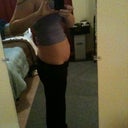 Before Tummy Tuck side view
