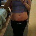before Tummy Tuck front view
