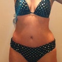 Notice how the swelling over the hips has gone down/away.  You can see the scar poking out on the left of the picture.