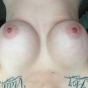 4 weeks post op