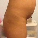 Side view.