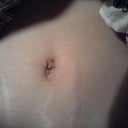 3wks 1 day po...after getting stitches out