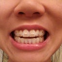 Tray 8