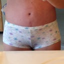 Panties hide the scar.  Still working on getting that spot below the bb healed