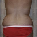 before surgery 10-12-2010