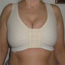 24 hours after explant! I bought this bra from Marena through Amazon.  It is great, the doctor said it was better than what they offer.