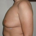 24 hours after explant, right view.