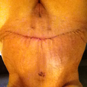 tummy PO 10 upside down sorry!!!!