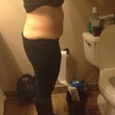 This photo is 1 month after lipo of the upper and lower abdomen...and 1 week after lipo of the flanks...shrinking slowly but surely!