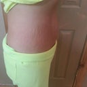 Before, side