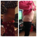 19 days post op alongside 6 weeks 6 days post op xx