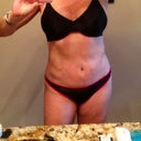 6 mos post