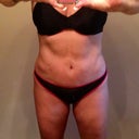 6 mos post
