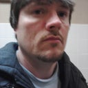 Also me before my first sculptra treatment n 2011