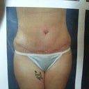 6 wks
