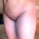 can you tell its bigg on the vagina?my skin is getting looser as swelling goees down.6weeks