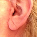 left ear scar just a little pink