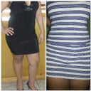difference from 4months pre op to 14 days post op