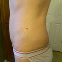 6 Months PO