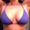 2 months post-op