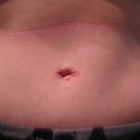 Stomach One