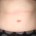 Stomach 2