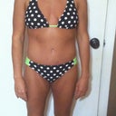 after tummy tuck (before breast aug and thigh lift)