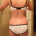 Preop back
