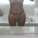6 weeks post op