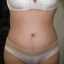 6 weeks