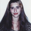 Before my surgery when I was 18 years old