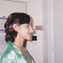 2 days before my surgery 21 years old