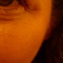 Week 9, skin is getting worse.  More wrinkling.  This photo demonstrate the texture change more effectively.
