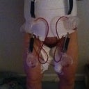 Post op front view. I have 4 drains. 2 for my tummy and 2 for my thighs. It is so nice not to have my thighs rubbing together when I walk!