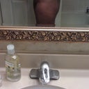 Pre op pic
