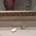 Pre op pic 2