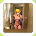 Lower abdomen is swollen.