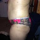 Post Revision - 2 weeks (left)