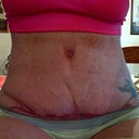 Week 4 Sitting down. You can really see the crease here.