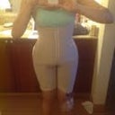 3 Days post op