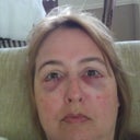 about 7 hours after
